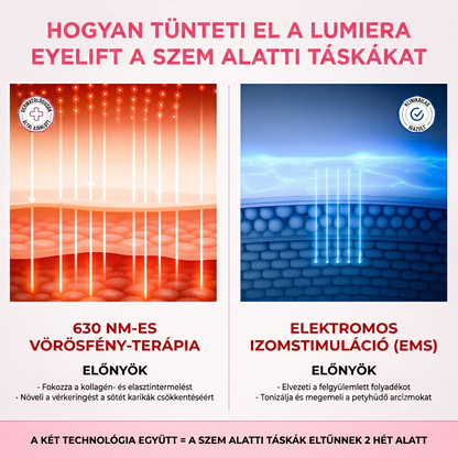 Lumiera EyeLift 2 az 1-ben vörösfény-terápia + EMS a szem alatti táskák eltüntetésére